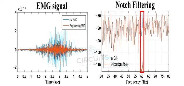 Why Is Notch Filter Used for EMG? Explained